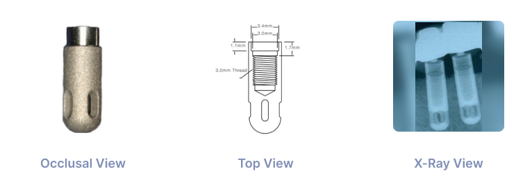 IMZインプラント Twin plus system IMZインプラント Twin plus system IMZインプラント Twin plus system